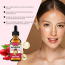 Rosehip Radiance Oil — Firm, Nourish & Rejuvenate