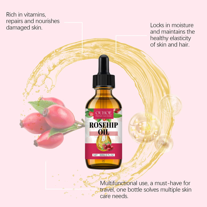 Rosehip Radiance Oil — Firm, Nourish & Rejuvenate
